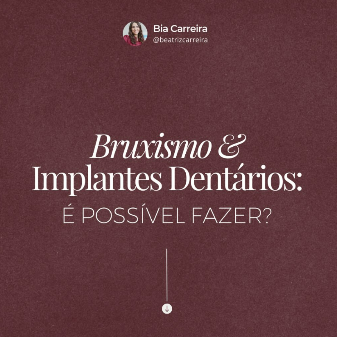 Bruxismo e Implantes Dentários