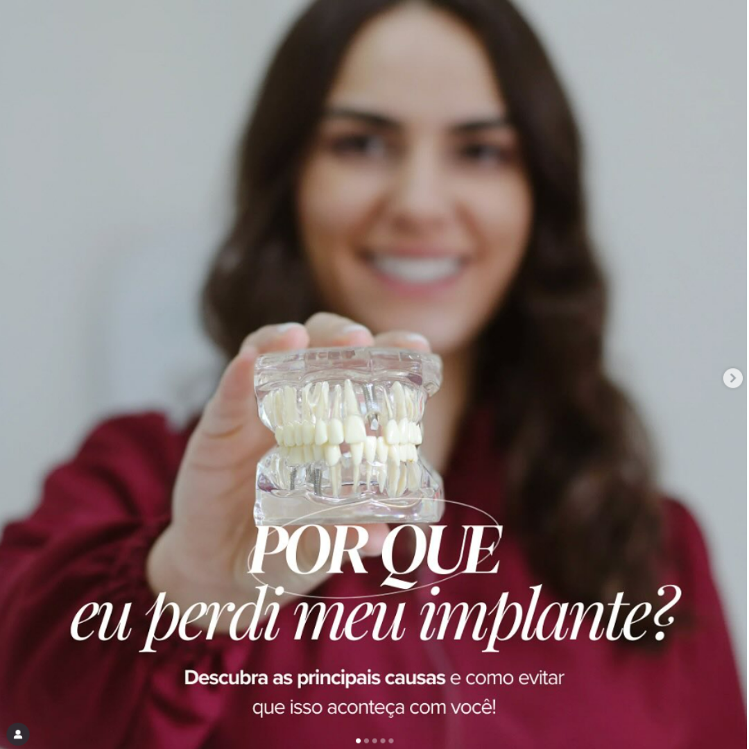 Por que perdi meu implante dentário? Entenda as causas e como evitar ?
