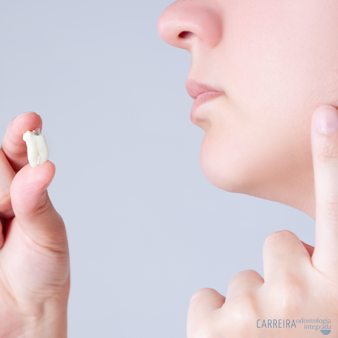 Extração de Dente: Quando é necessária e como é feita?